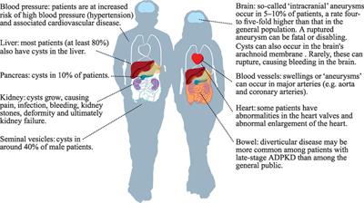 Is It Ethical to Test Apparently “Healthy” Children for Autosomal Dominant Polycystic Kidney Disease and Risk Medicalizing Thousands?